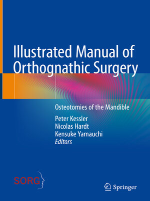 cover image of Illustrated Manual of Orthognathic Surgery